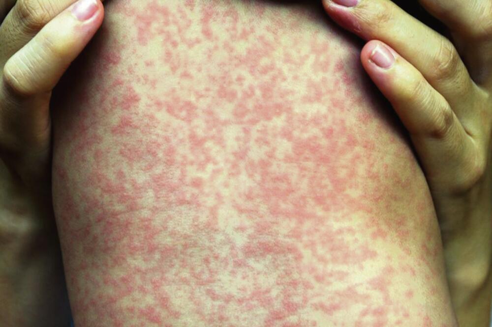 3821455_0608-male-boginje_ls