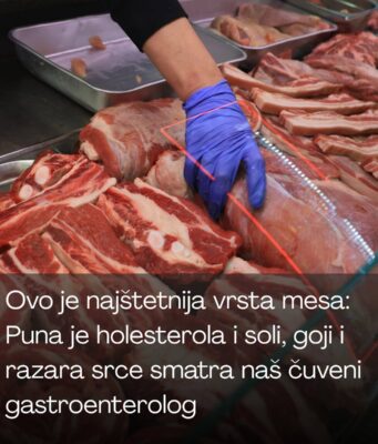 Ovo je najštetnija vrsta mesa: Puna je holesterola i soli, goji i razara srce smatra naš čuveni gastroenterolog